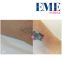 Vega QS by EME Estetica laser a tecnologia Q-Switched Nd:YAG ideale per rimuovere i tatuaggi EI1803